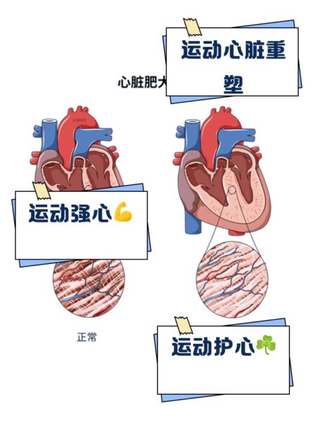 体能健将为何频现心脏危机？拆解运动与心源性猝死...